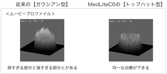MedLite C6(メドライトC6)の照射の特徴